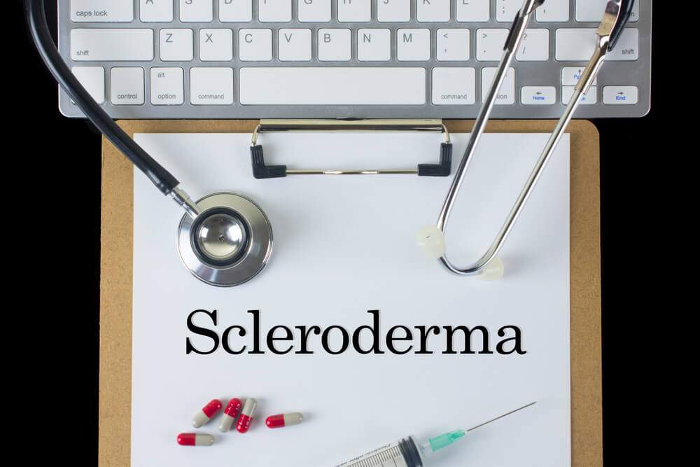 How to treat scleroderma