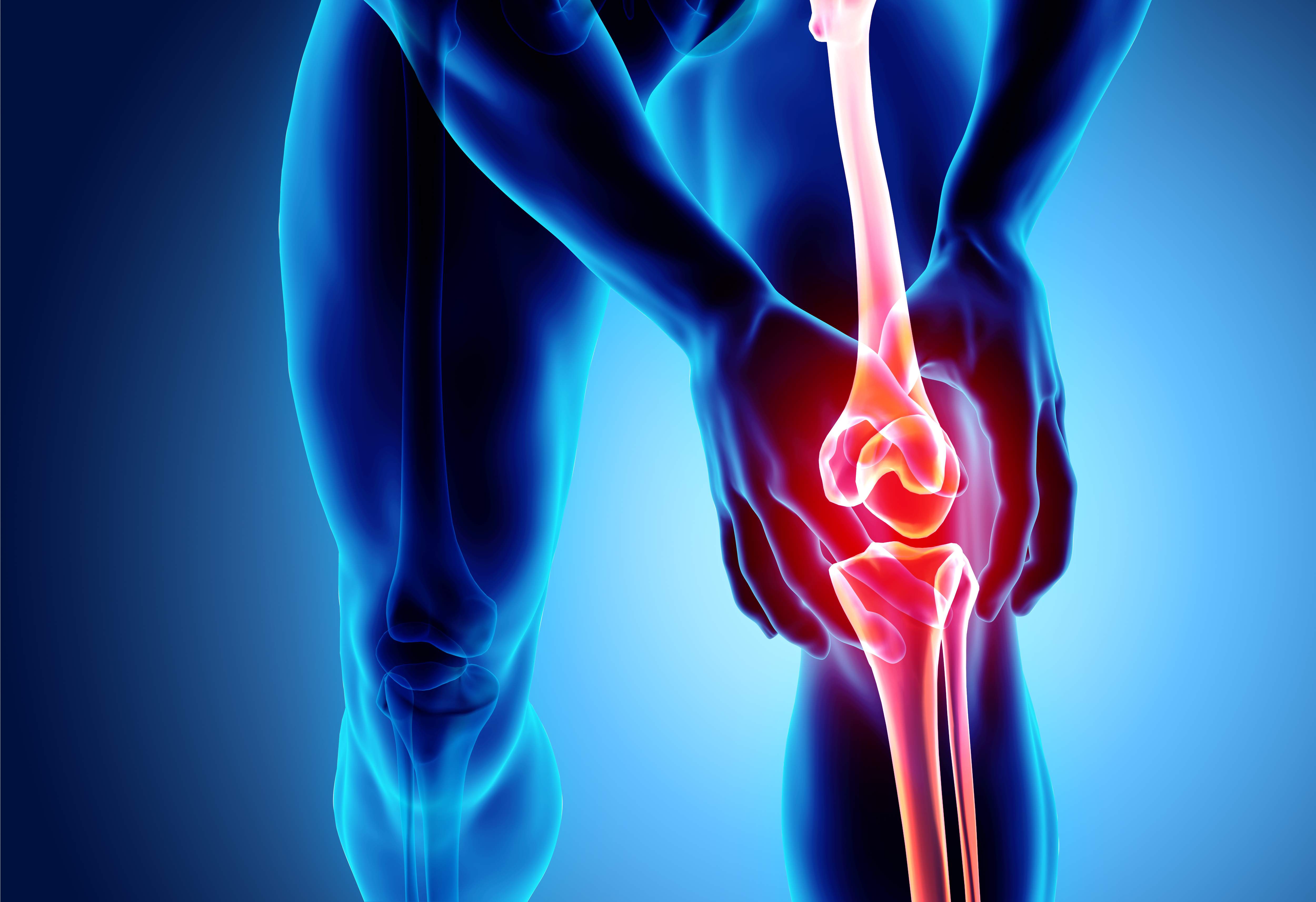 Inflamed knee joint