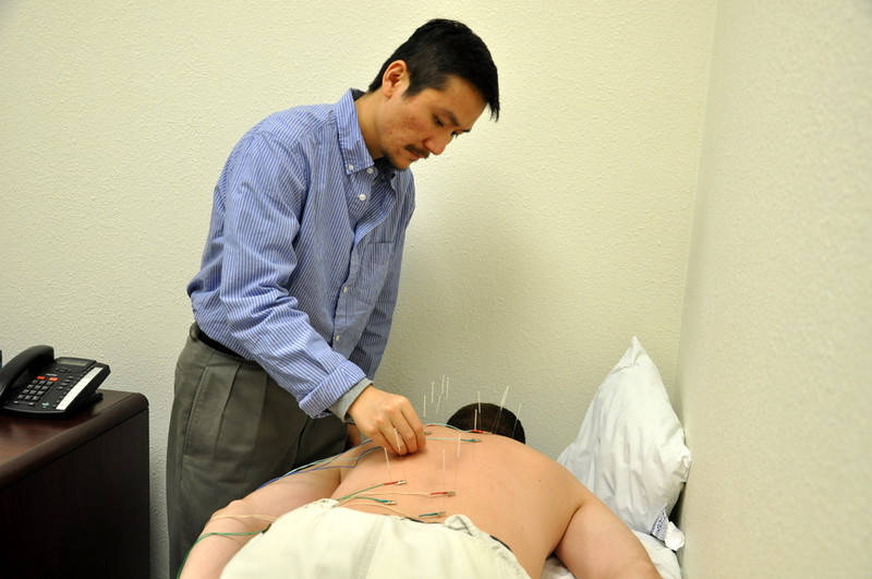 physical therapy and acupuncture 1 Almagia